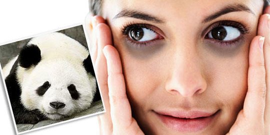 Kenali Penyebab Mata Panda, Salah Satunya Tanpa Sadar Sering Kita Lakukan