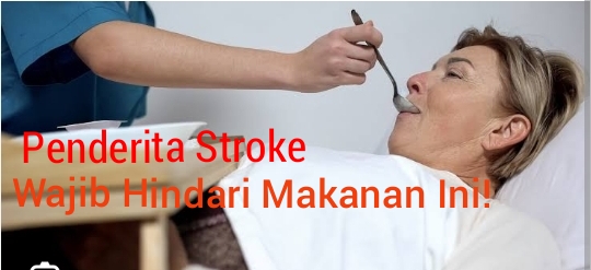 Penderita Stroke Hindari Makanan Ini! Perhatikan Nomor 3