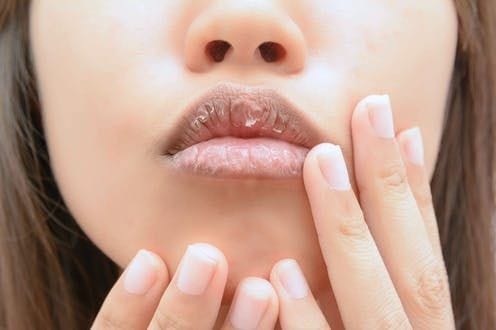 Punya Keluhan Bibir Tidak Sehat? Cobalah Konsumsi Makanan Ini Agar Bibir Sehat!