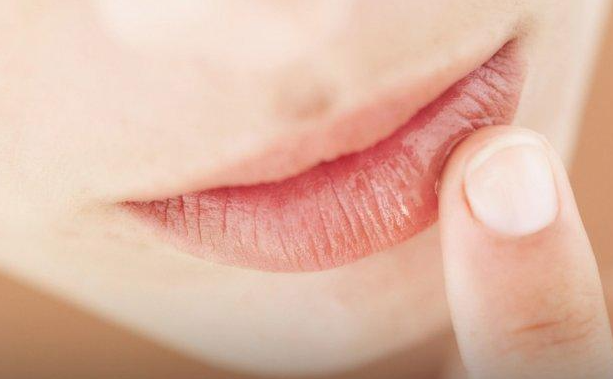 Penyebab dan Cara Mengatasi Bibir kering yang Jarang Tersadari