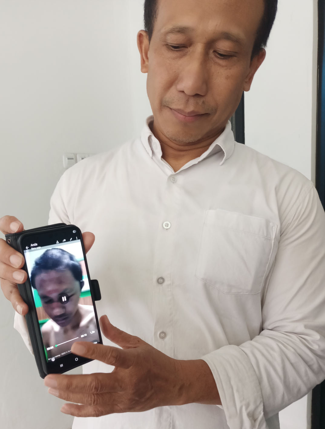 Diduga Dikeroyok 30 Mahasiswa, Mahasiswa Undip Alami Patah Hidung dan Gegar Otak