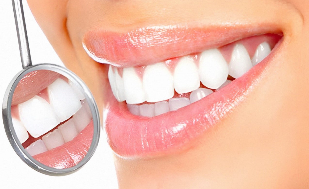 Gigi Putih Hanya dalam Waktu Seminggu Saja Tanpa Perlu ke Dokter