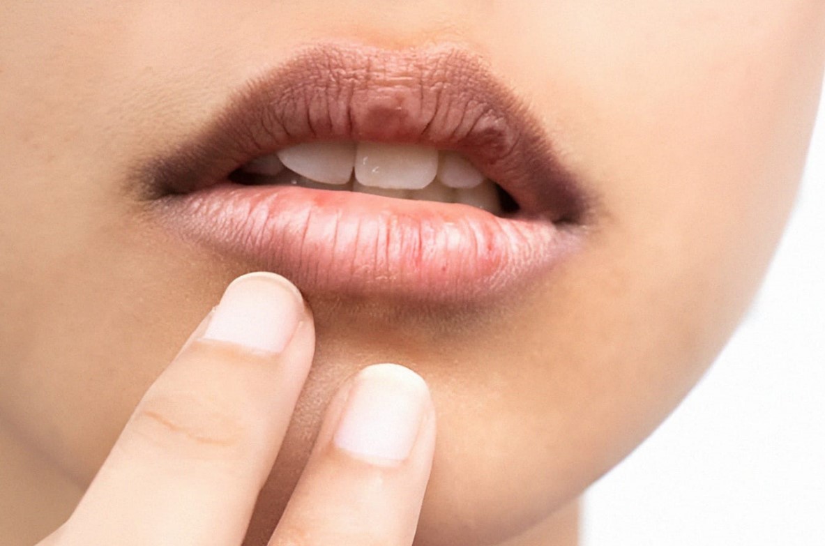 Cara Mudah Mengatasi Bibir Kering dengan Bahan-Bahan Alami