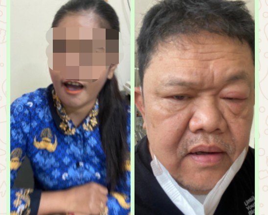Mantan Ketua DPRD Salatiga Teddy Sulistyo Diduga Mendapat Layanan 'Judes' Pegawai RS dr Soebarkat Salatiga