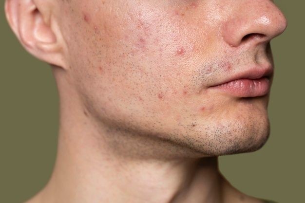 Seberapa Pentingkah Skincare untuk Pria? Cek 4 Fakta dan Manfaat untuk Kulit yang Sehat