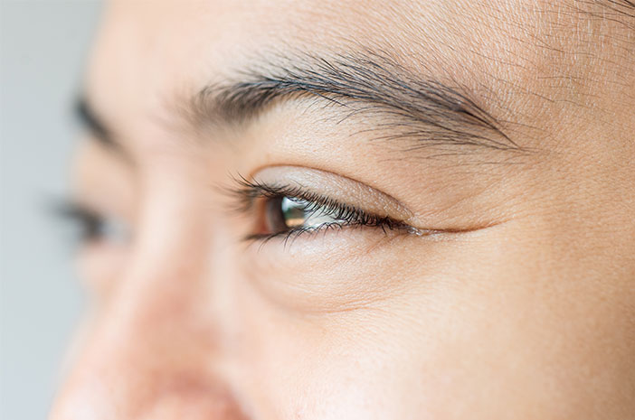 8 Faktor Penyebab Munculnya Kerutan di Bawah Mata