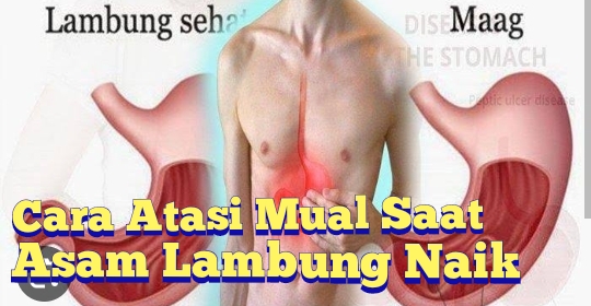 Ada 9 Cara Mengatasi Mual Saat Asam Lambung Naik, Ini Dia