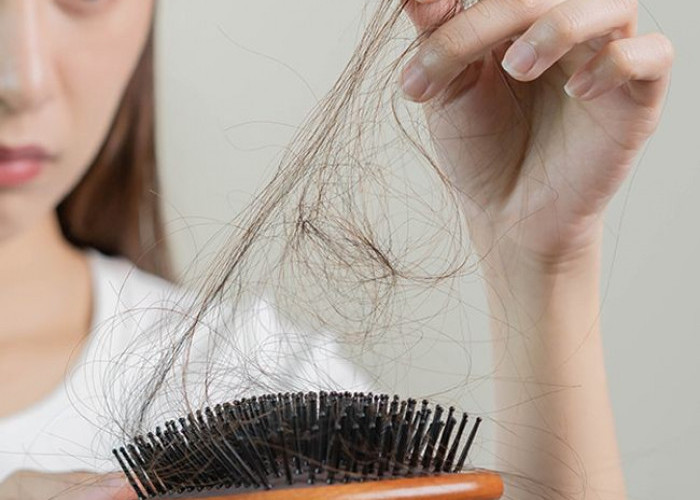 5 Rekomendasi Produk Perawatan Rambut yang Rusak dan Kering, Suburkan Mahkota Super Cepat 