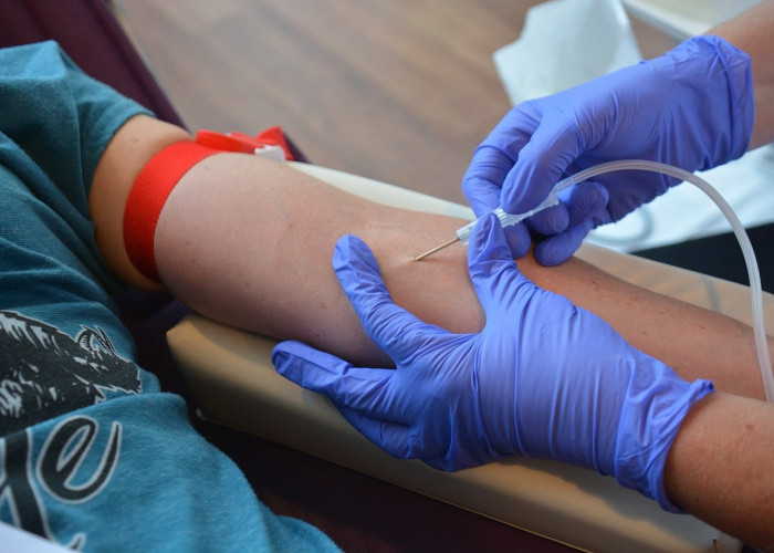 Dampak Cut Off UHC Batang, BPJS Pasien Kronis Nonaktif saat Transfusi, Ini Respon Bupati 