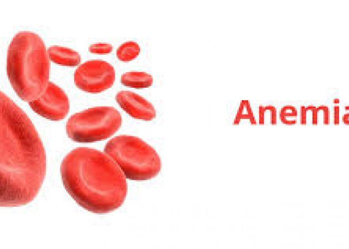 7 Cara Mengatasi Anemia dengan Cepat, Dijamin Ampuh 
