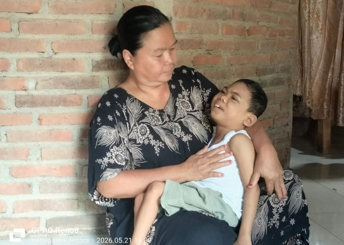 Kisah Pilu Bocah Cerebral Palsy di Jepara, Dika Saputra Bertahan Hidup di Tengah Himpitan Ekonomi