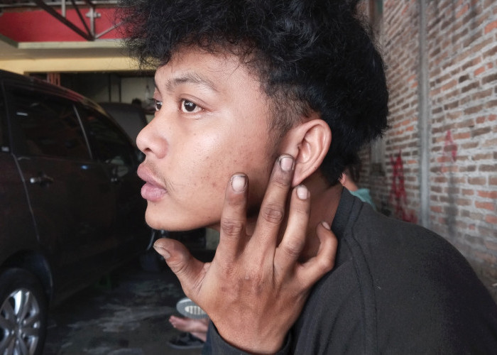 Korban Pengeroyokan Konvoi Perguruan Silat di Boyolali Resmi Lapor Polisi, Adam Alif: Lebih 20 Pertanyaan