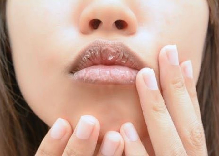 Punya Keluhan Bibir Tidak Sehat? Cobalah Konsumsi Makanan Ini Agar Bibir Sehat!