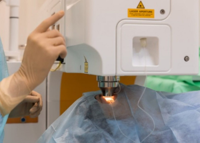 Mau Bebas Kacamata? Wajib Tahu 7 Fakta Ini Sebelum Nekat Operasi LASIK!