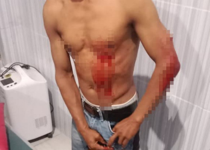 Keributan di Pesta Pernikahan Jiken Blora, Remaja Tusuk Warga dengan Pisau