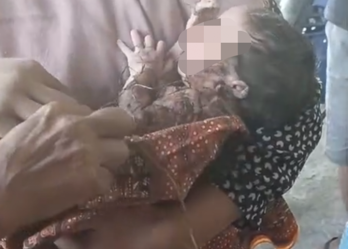 Warga Sekarsuli Klaten Utara Digegerkan Penemuan Bayi Perempuan Terluka di Persawahan