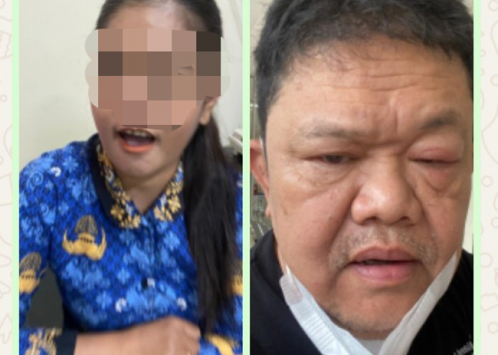 Mantan Ketua DPRD Salatiga Teddy Sulistyo Diduga Mendapat Perlayanan 'Judes' Pegawai RS dr Soebarkat Salatiga