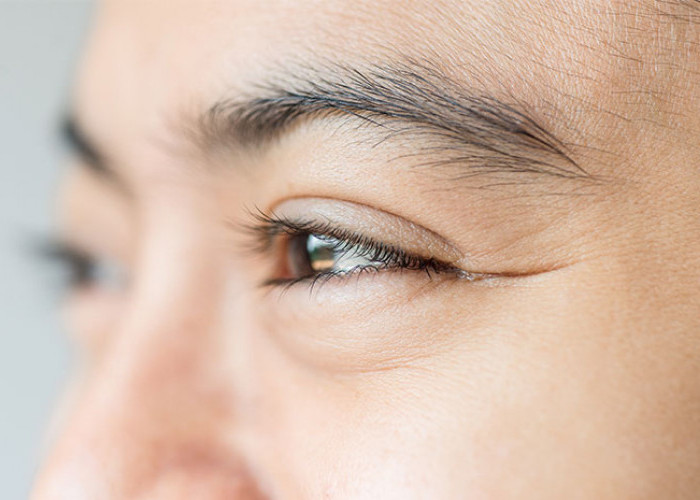 8 Faktor Penyebab Munculnya Kerutan di Bawah Mata