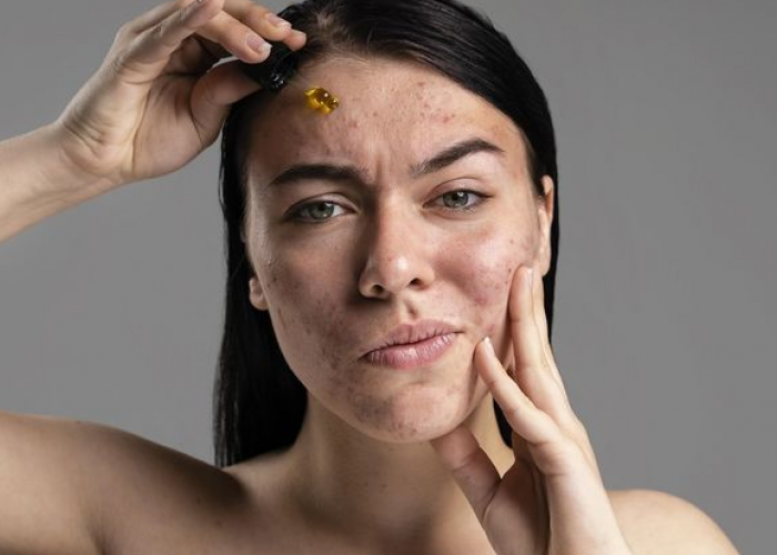 Penyebab Gonta Ganti Skincare, Apakah Buruk untuk Wajah? Ternyata Bisa Menyebabkan Ini!