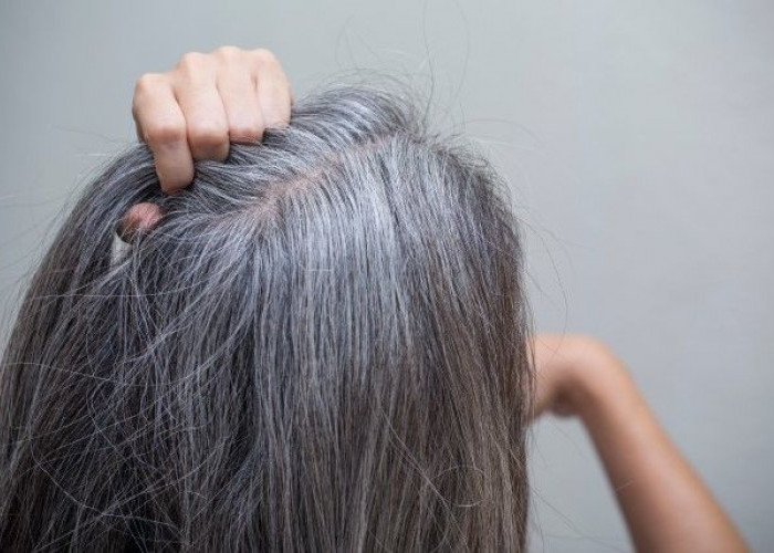 Rambut Beruban, Benarkah Karena Faktor Usia Saja? Berikut 6 Penyebab Munculnya Uban