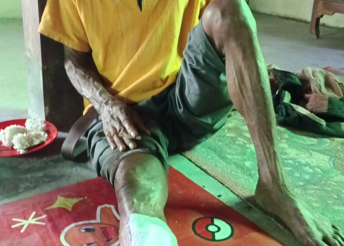 Mulai Makan Korban! Kabel Wi-Fi Dekat Rumdin Bupati Jerat Pasutri Pedagang Gethuk