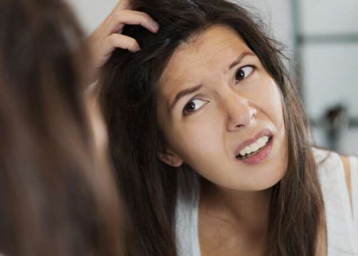 10 Penyebab dan Cara Mengatasi Ketombe di Kepala, Salah Satunya Rutin Pakai Masker Rambut