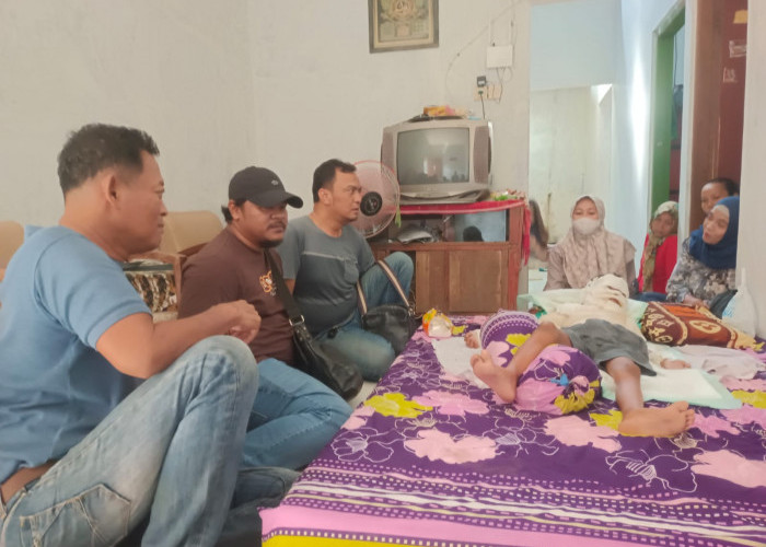 Komisi IV DPRD Batang Sambangi Bocah Luka Bakar, Minta Pemda Turun