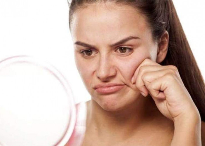 4 Penyebab Minyak Berlebih pada Wajah dan Tips Ampuh Mengatasinya, Jangan Ragu Untuk Mencobanya