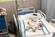 Diserang Monyet Liar Bayi 4 Bulan di Demak Terluka