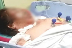 Wanita Lansia di Jepara Meninggal, Luka Sekujur Tubuh Akibat Dibakar Mantan Menantu