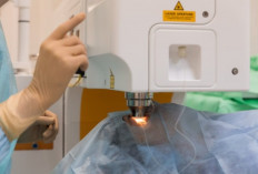 Mau Bebas Kacamata? Wajib Tahu 7 Fakta Ini Sebelum Nekat Operasi LASIK!