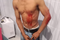 Keributan di Pesta Pernikahan Jiken Blora, Remaja Tusuk Warga dengan Pisau