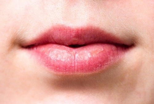Alami Bibir Pecah-pecah, Kering, dan Sulit untuk Membuka Mulut ? Ini Penyebabnya